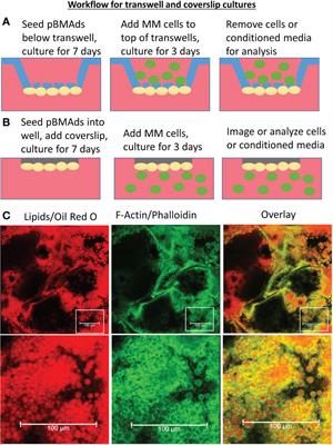 Development and characterization of three cell culture systems to investigate the relationship between primary bone marrow adipocytes and myeloma cells